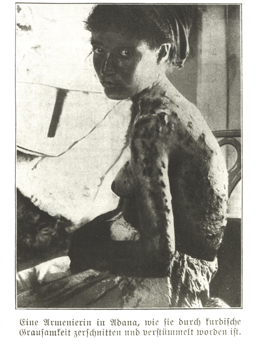 Armenierin aus Adana - (Ref-Nr. img013)