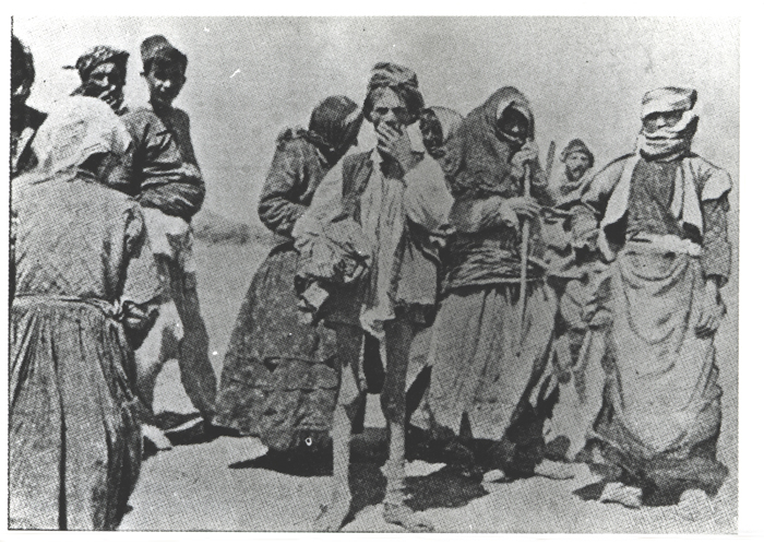 Zum Skelett abgemagerte Deportierte - (Ref-Nr. img045)